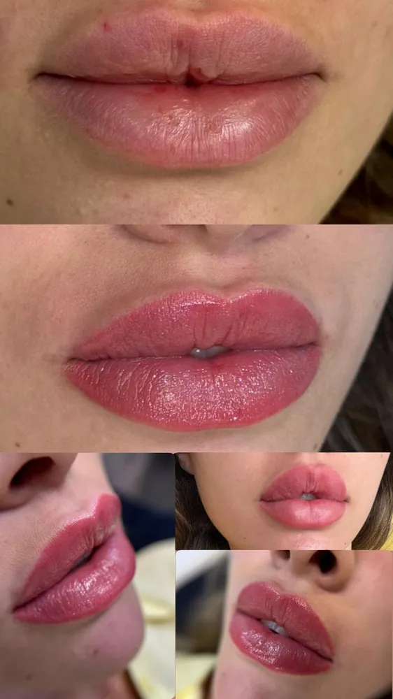 Lip blush before and after